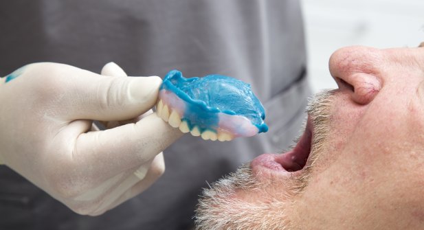 Remboursement prothèses dentaires fixes