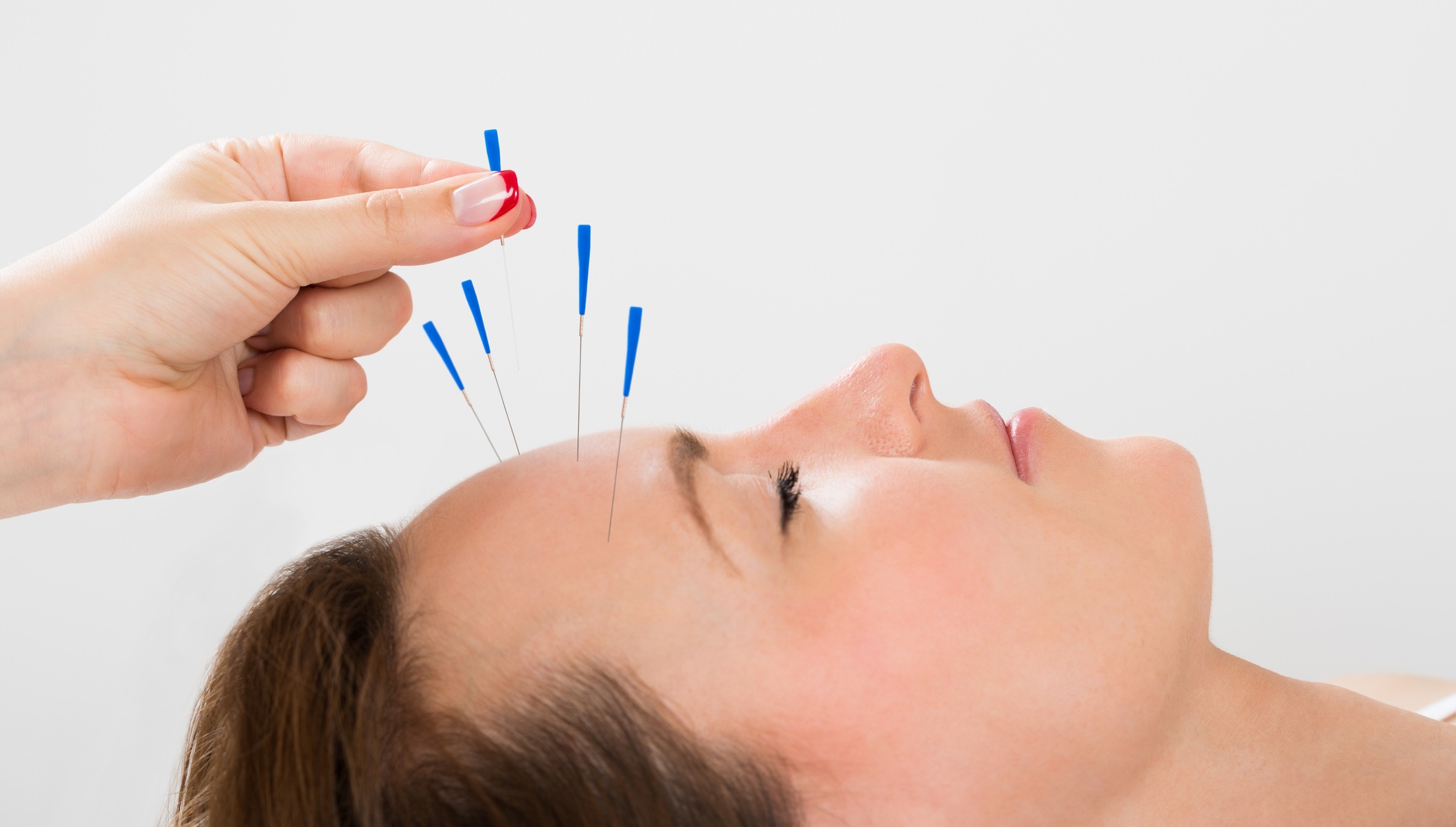 Acupuncture – Les remboursements mutuelles