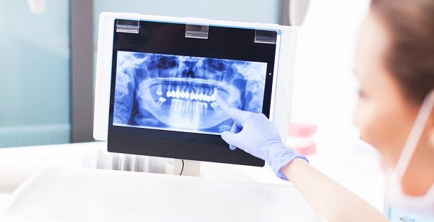 Orthodontie : quel remboursement ?