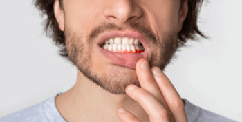 Parodontologie : quel remboursement ?